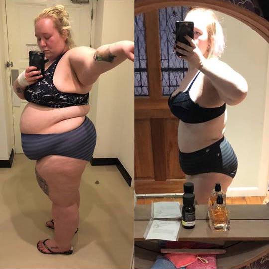 jess before after gastric sleeve