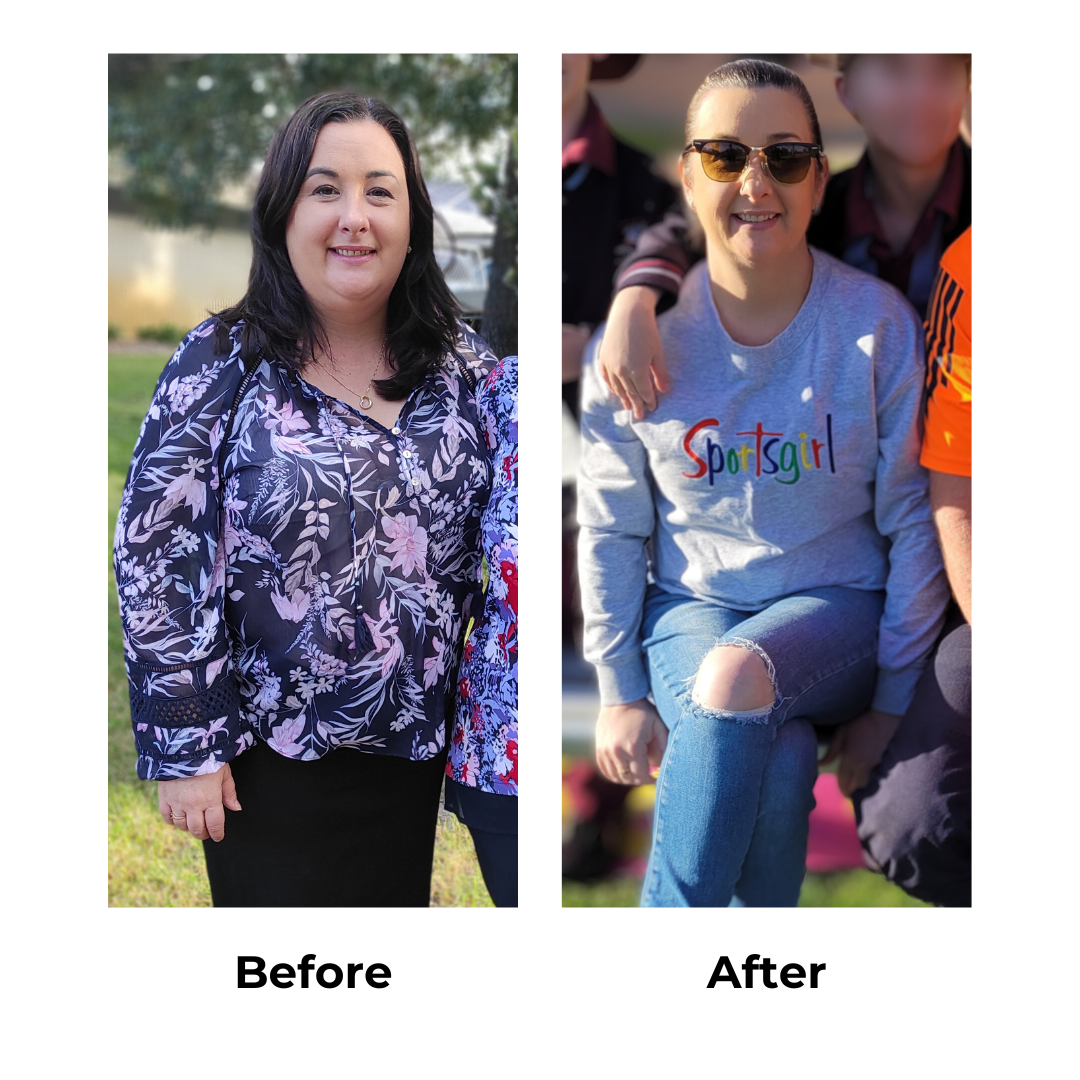 Alison had gastric sleeve in Thailand