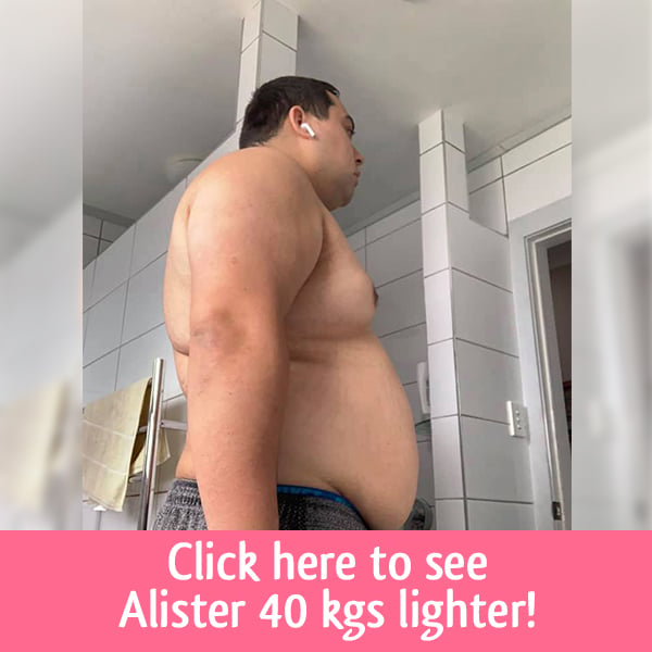 Alister gastric sleeve