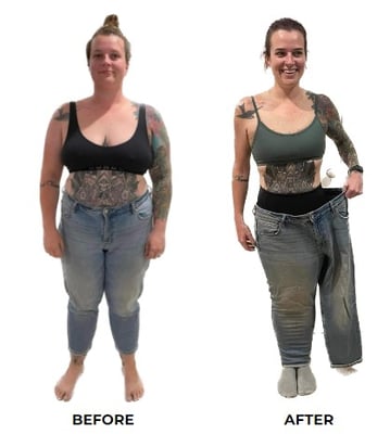 Amelia before after weight loss surgery 3