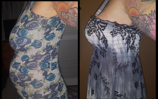 before and after mummy makeover thailand before and after mummy makeover thailand