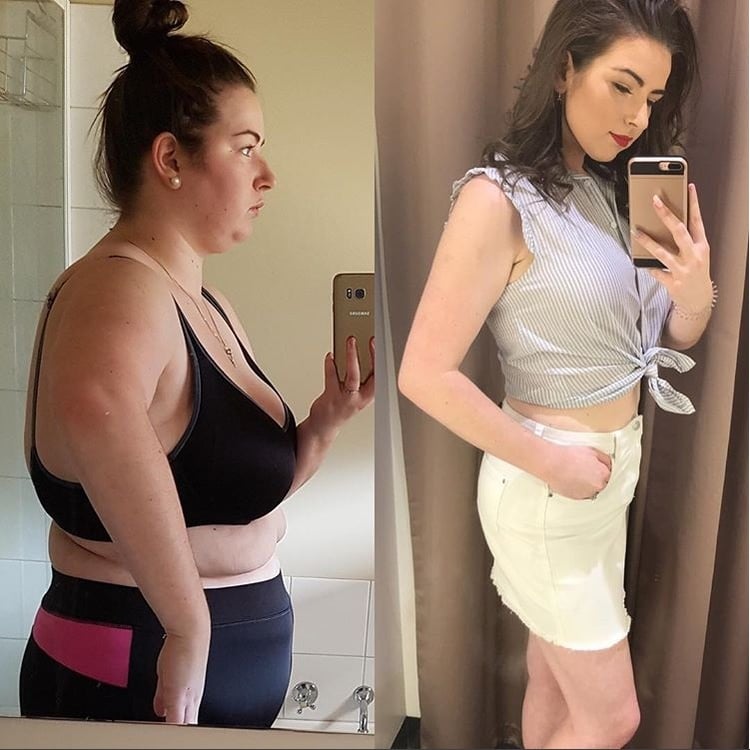 Ashley before and after gastric sleeve 2