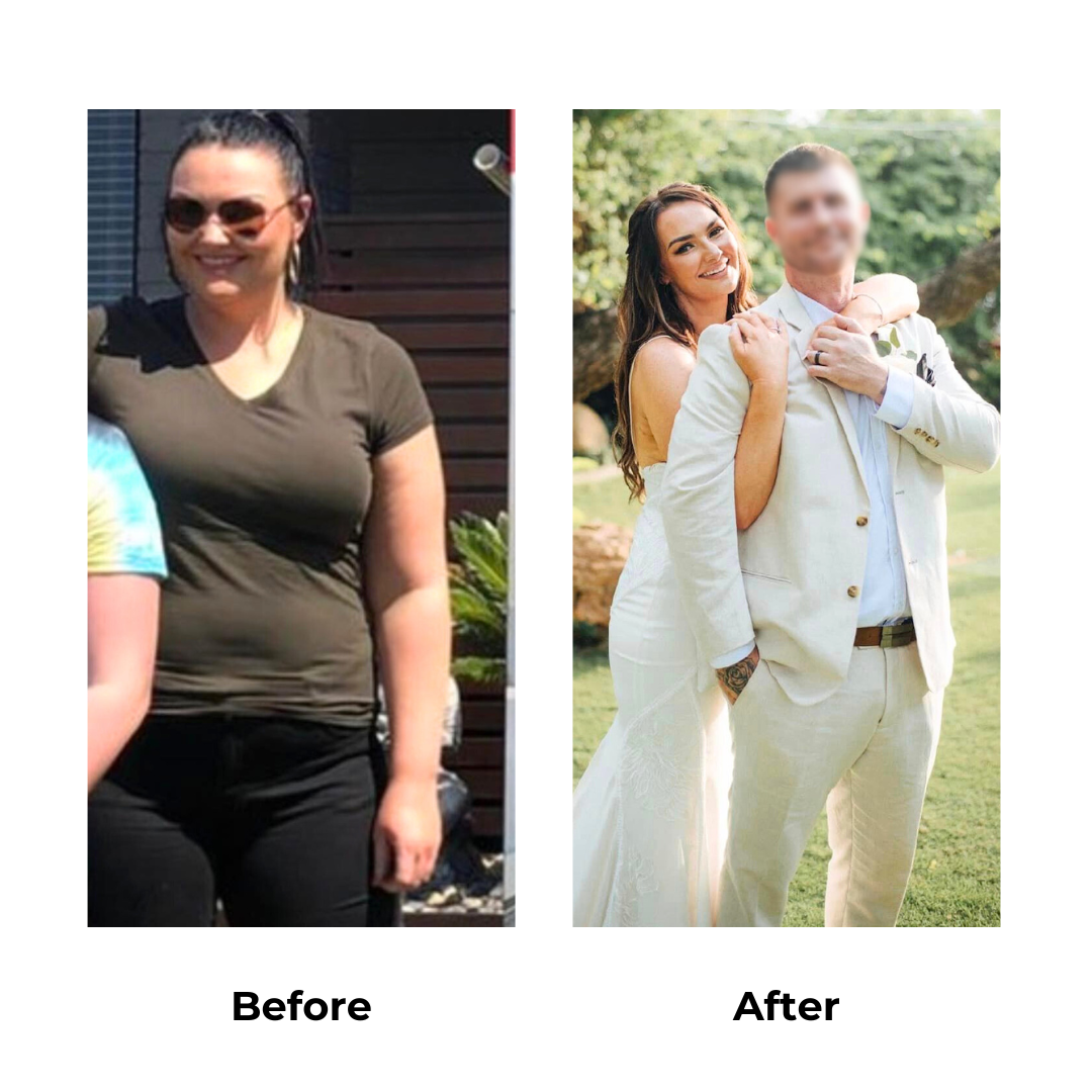 Ashley had gastric sleeve