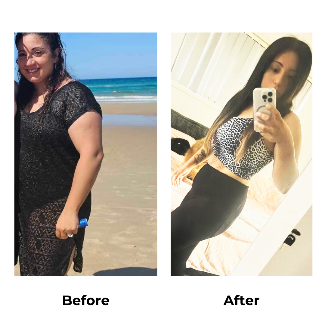 Ayse before and after gastric sleeve