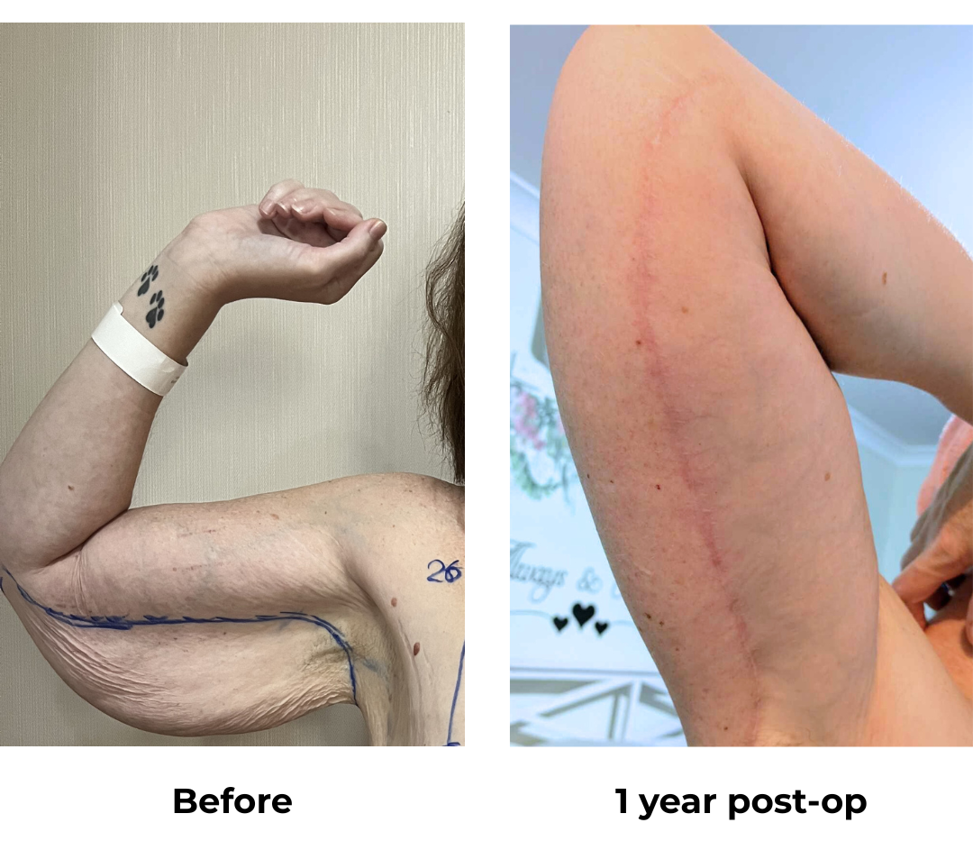 Belinda 1 year (2)-1