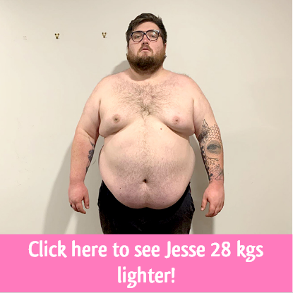 jesse gastric sleeve