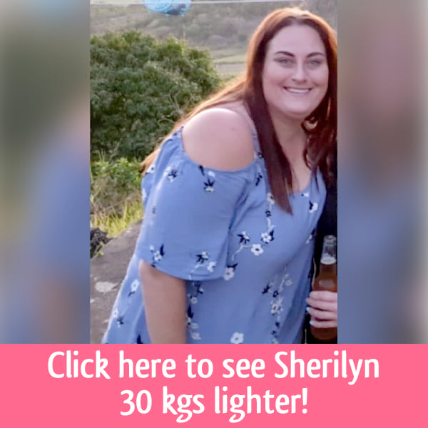  Sherilyn weight loss surgery