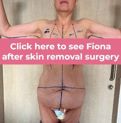 Click to see Fiona-1