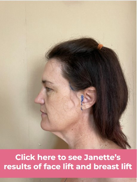 Click to see Janette-1