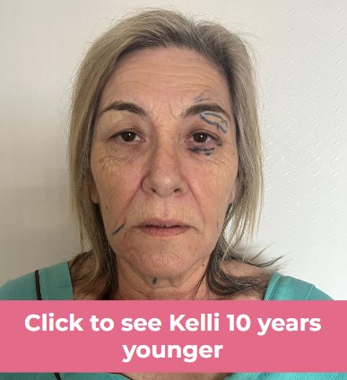 Click to see Kelli FL-1