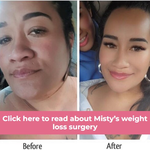 Click to see Misty WLS