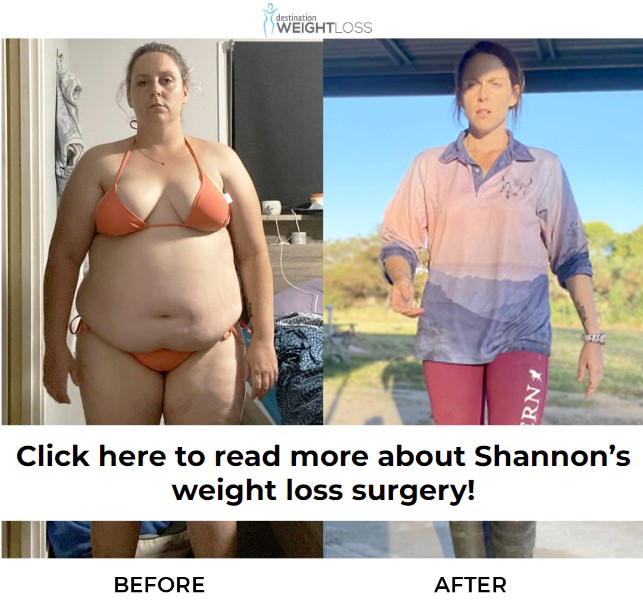 Click to see Shannon before and after WLS