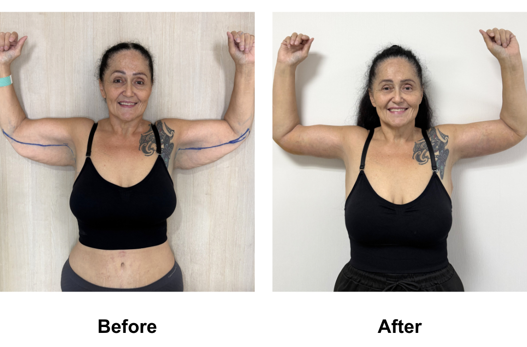 Colleen had extended AL with Dr. Ring (1)