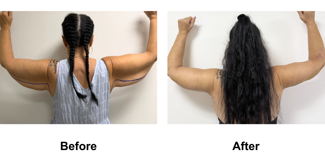 Colleen had extended AL with Dr. Ring