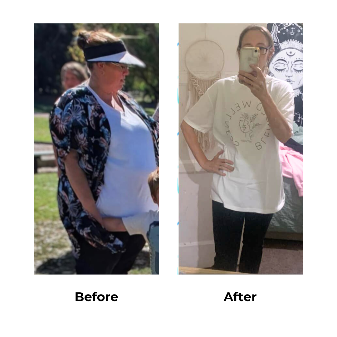 Donna had weight loss surgery (2)