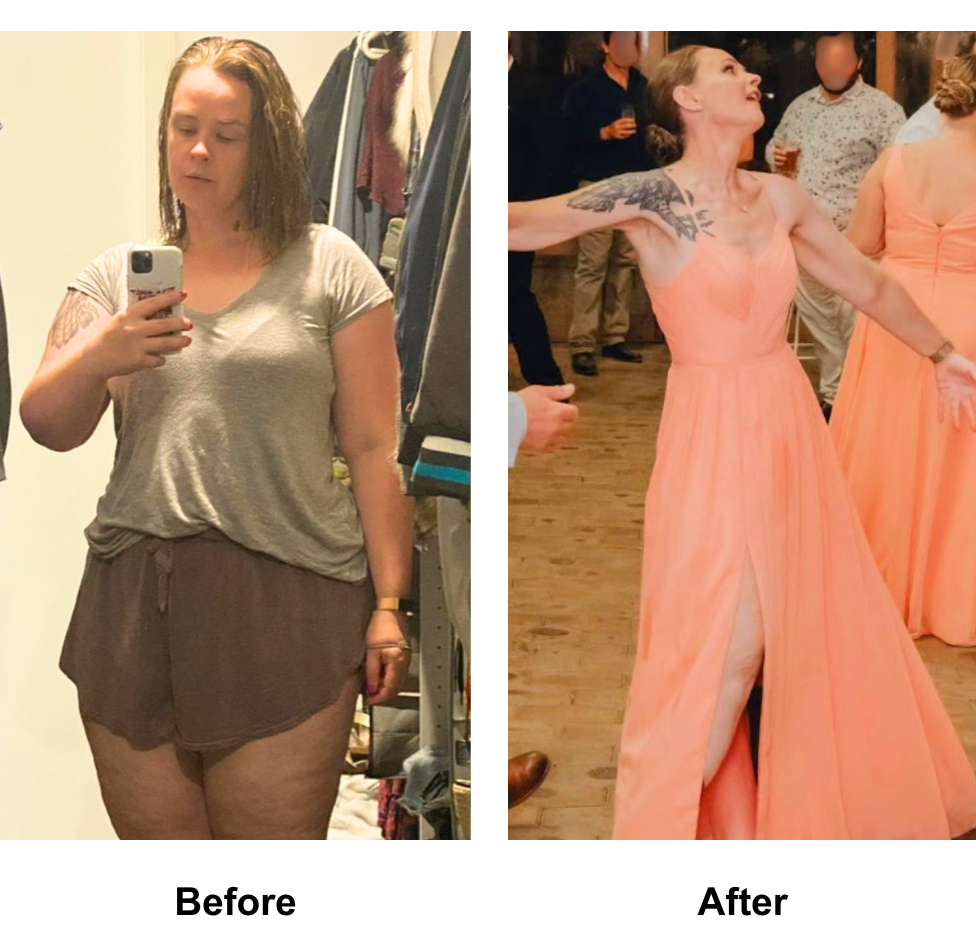 Eliza had weight loss surgery