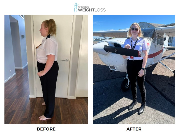 Emily Cook weight loss surgery 4
