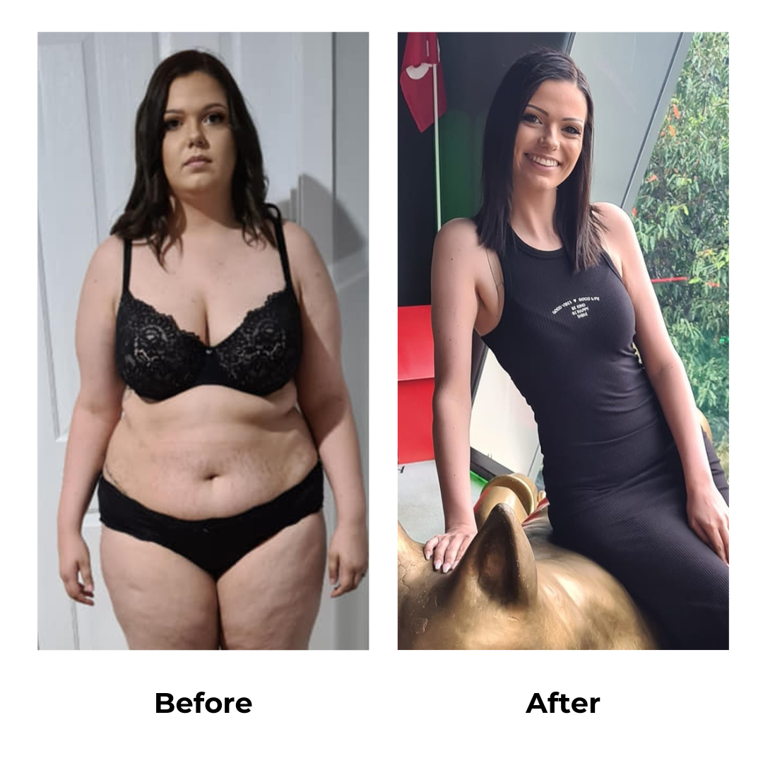 Hope had weight loss surgery (2)