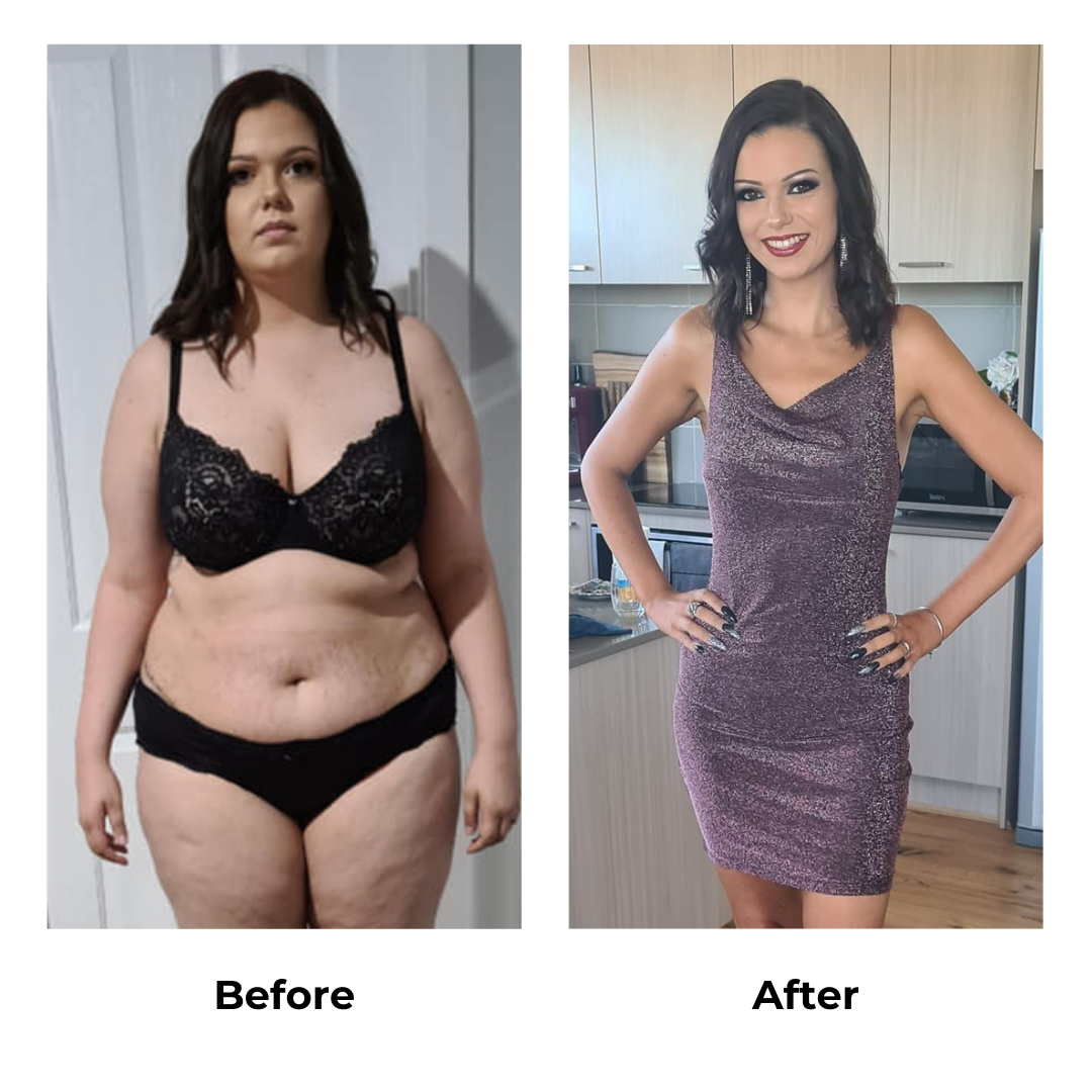 Hope had weight loss surgery