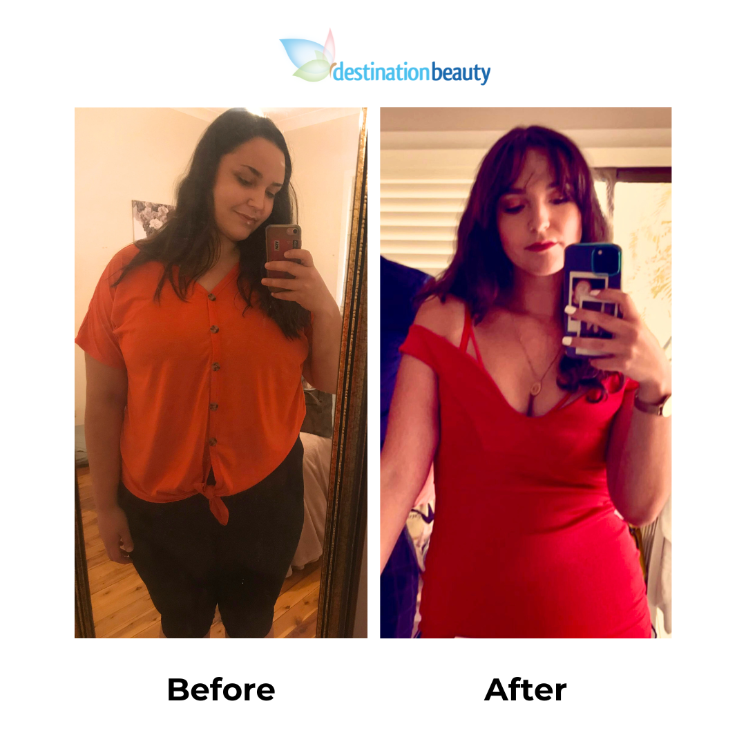 Inaya had weight loss surgery