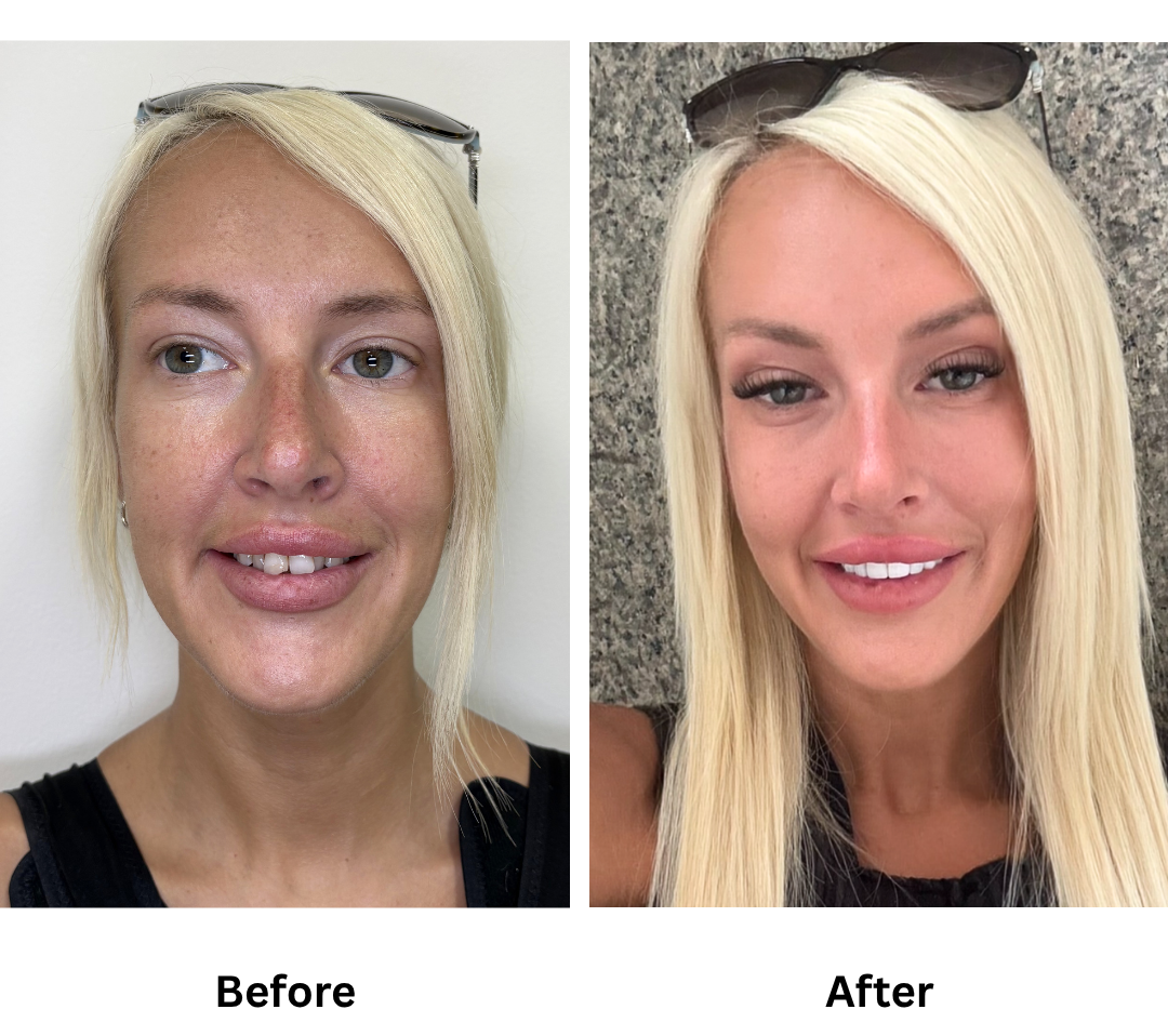 Jade Craig Before after (1)