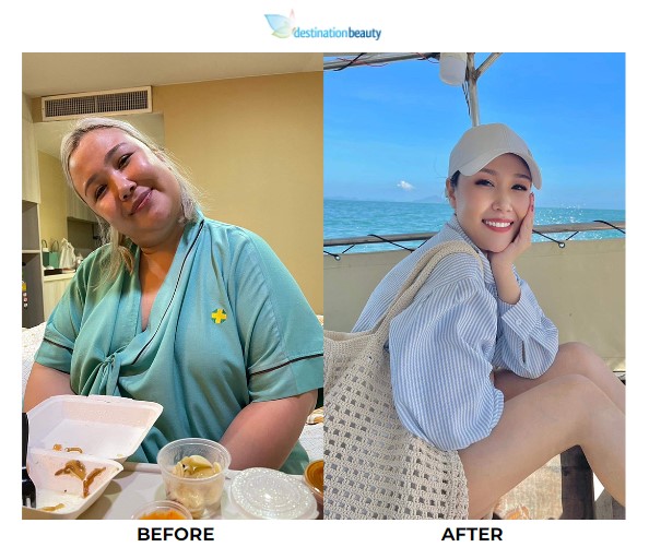 Jah weight loss surgery 2