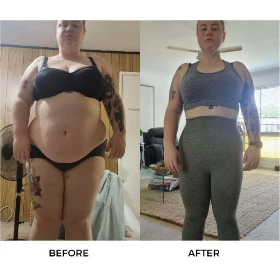 Jessica had weight loss surgery