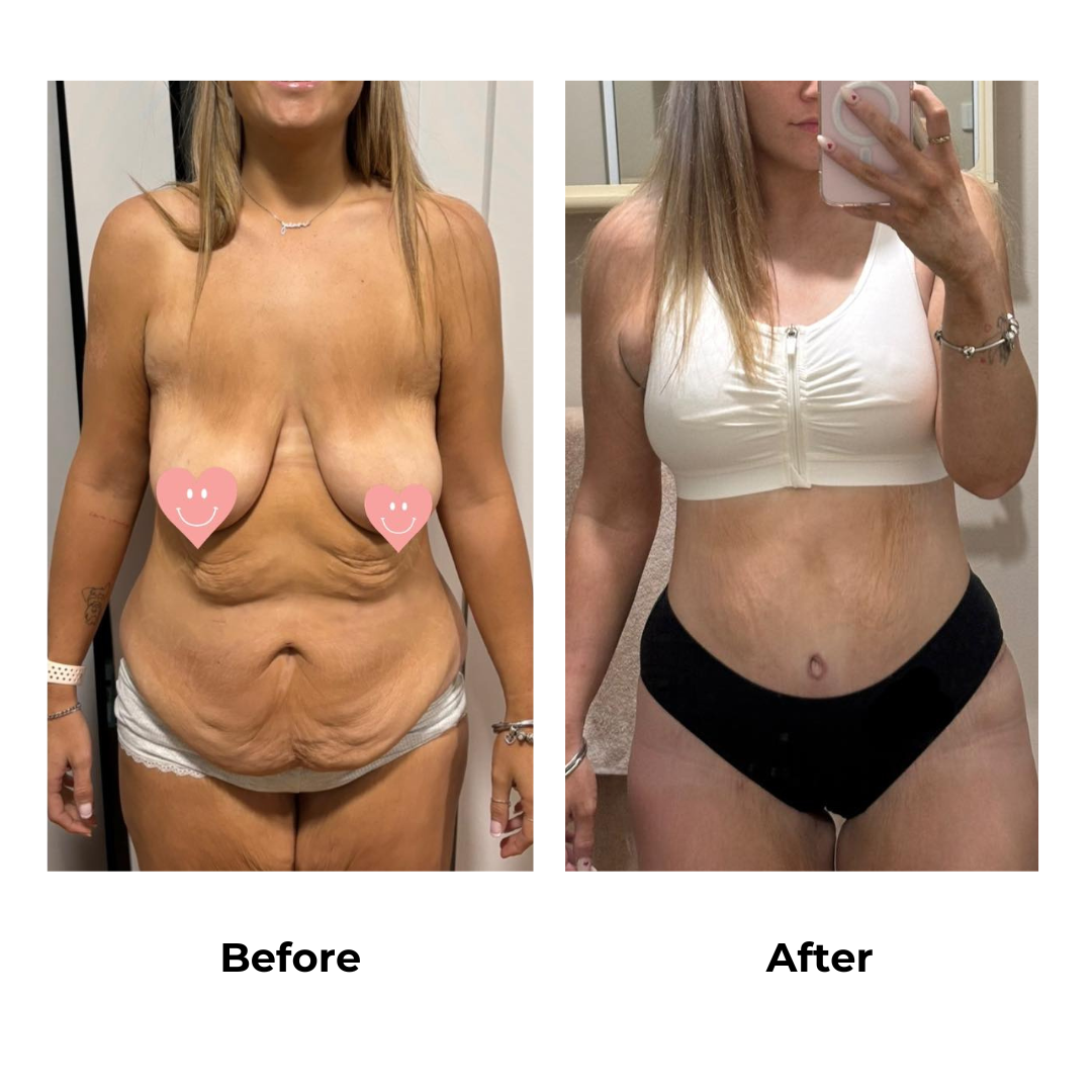 Jezaire skin removal in Thailand