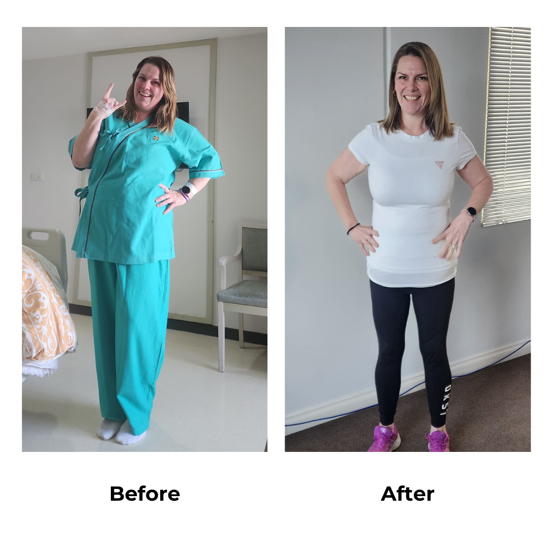 Katherine had gastric sleeve in Thailand (2)