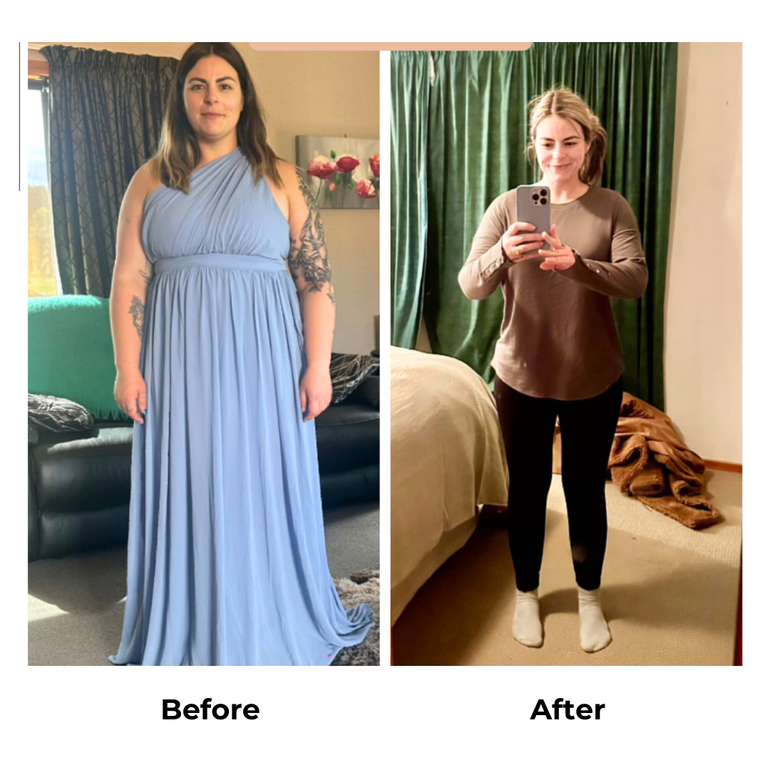 Kaylan had gastric sleeve in Thailand