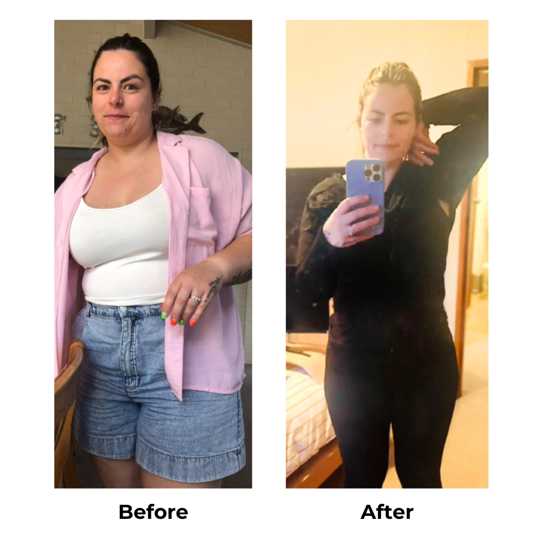 Kaylan had gastric sleeve