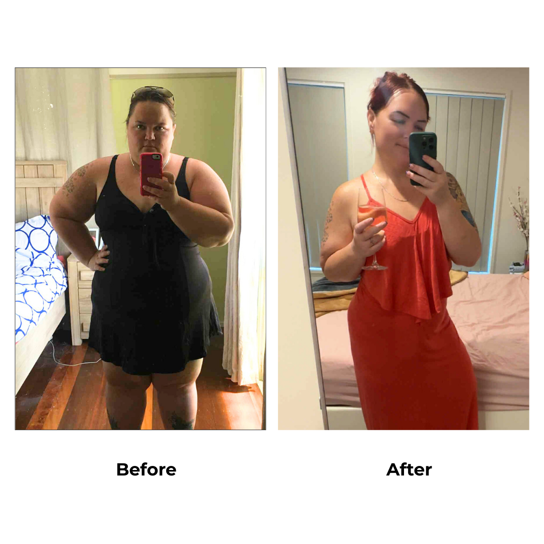Kirsten had weight loss surgery