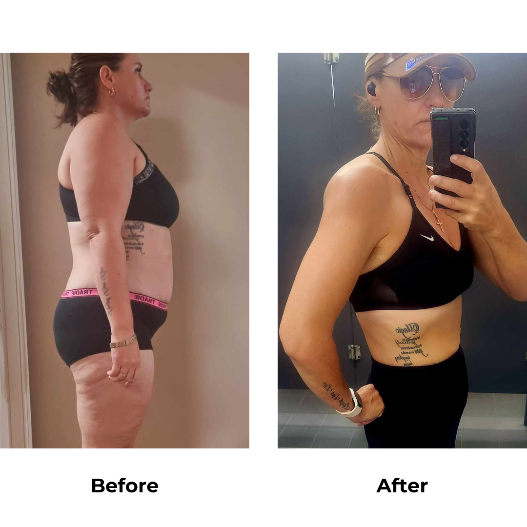 Kristie had gastric sleeve surgery