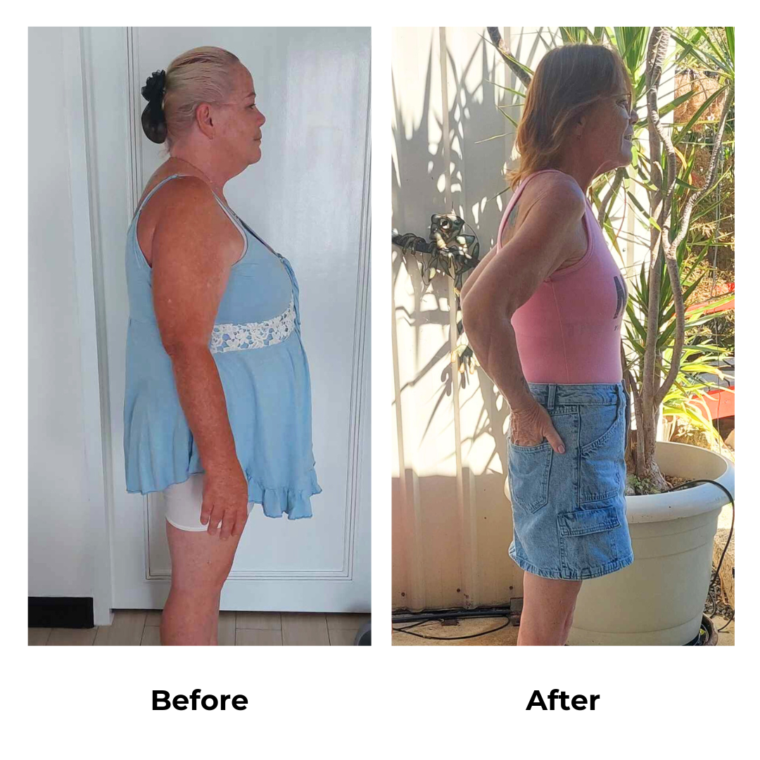 Lee-Ann had gastric sleeve in Thailand