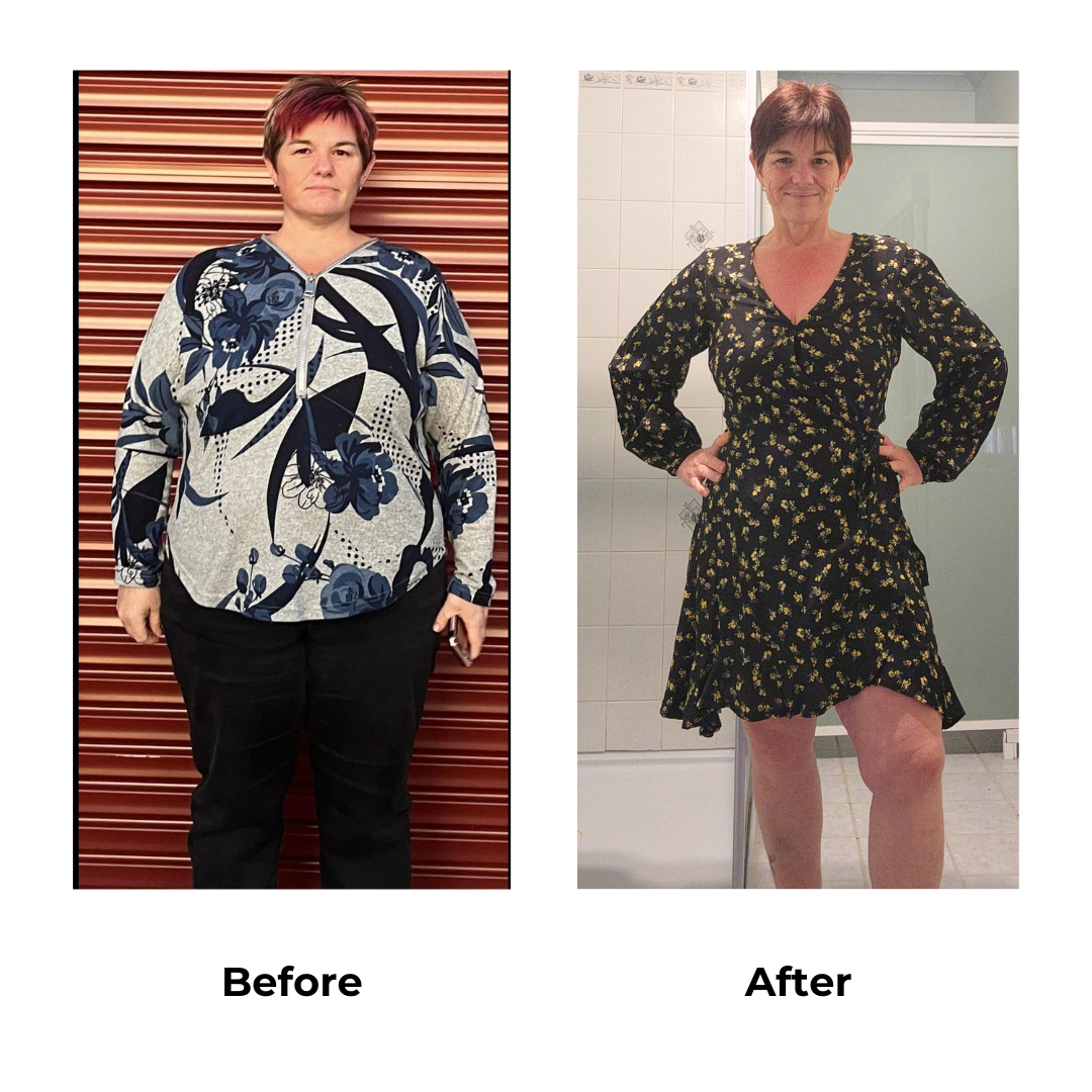 Mary had gastric sleeve