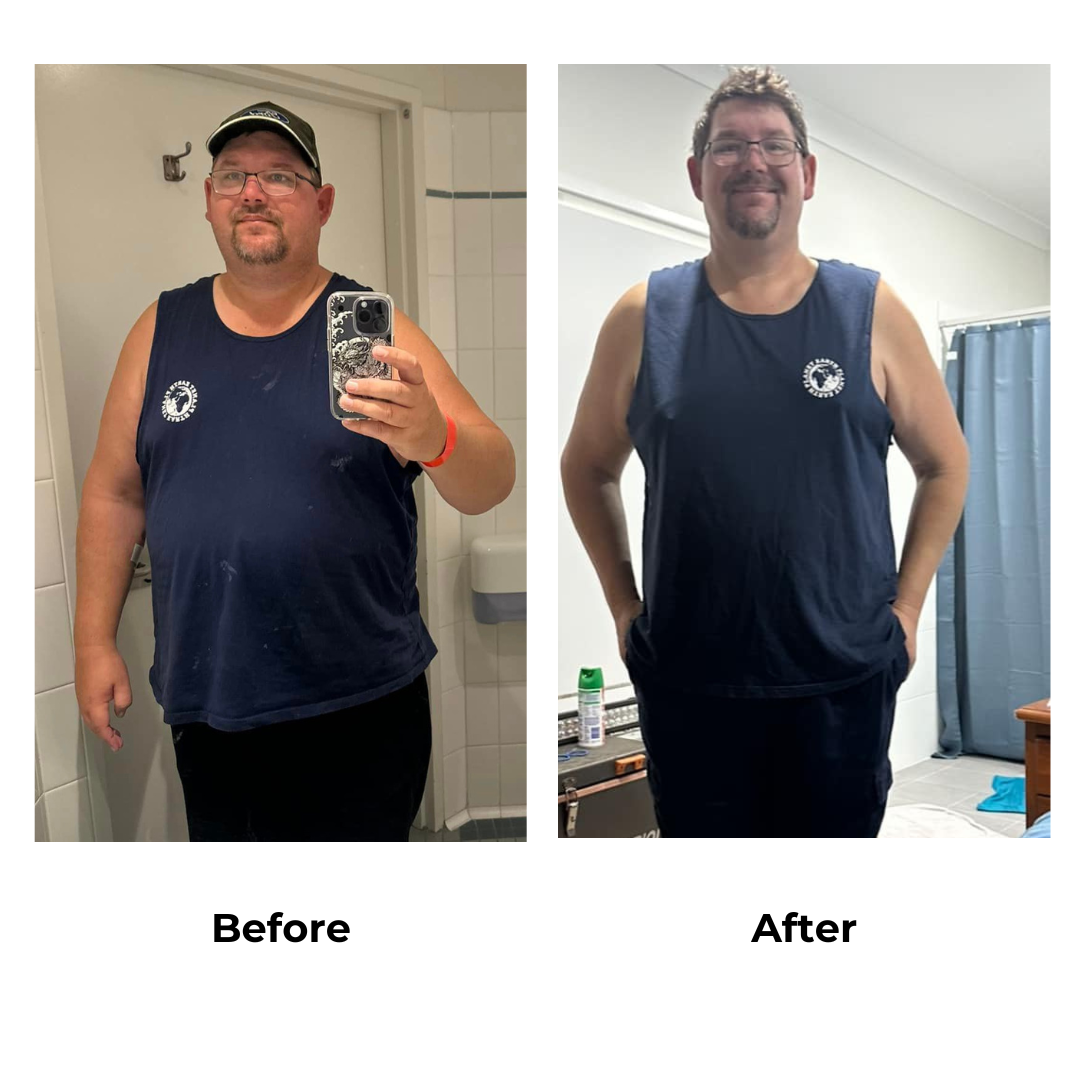 Matthew had gastric sleeve