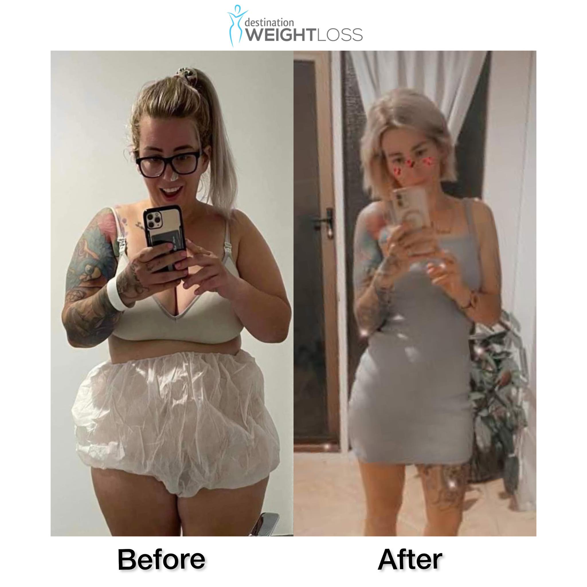 Melissa before after WLS 2