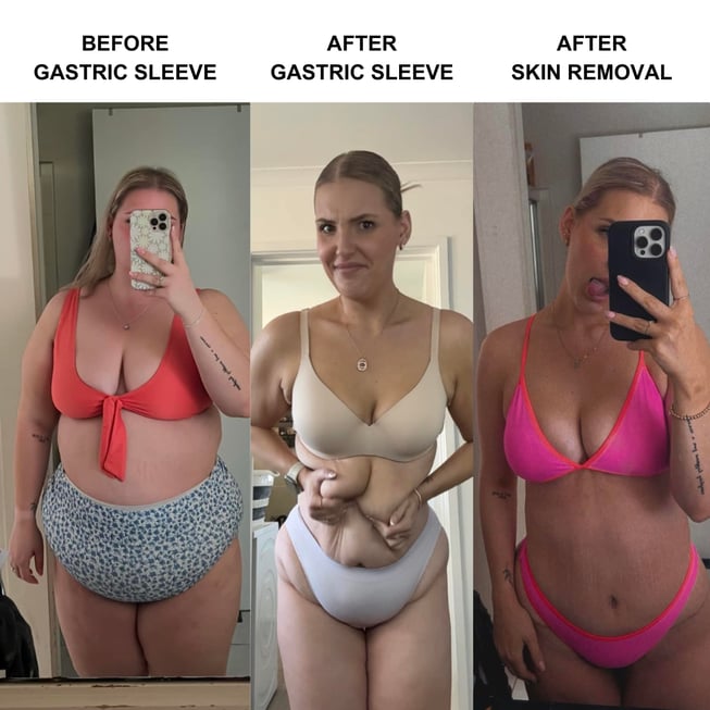 Mikayla full journey