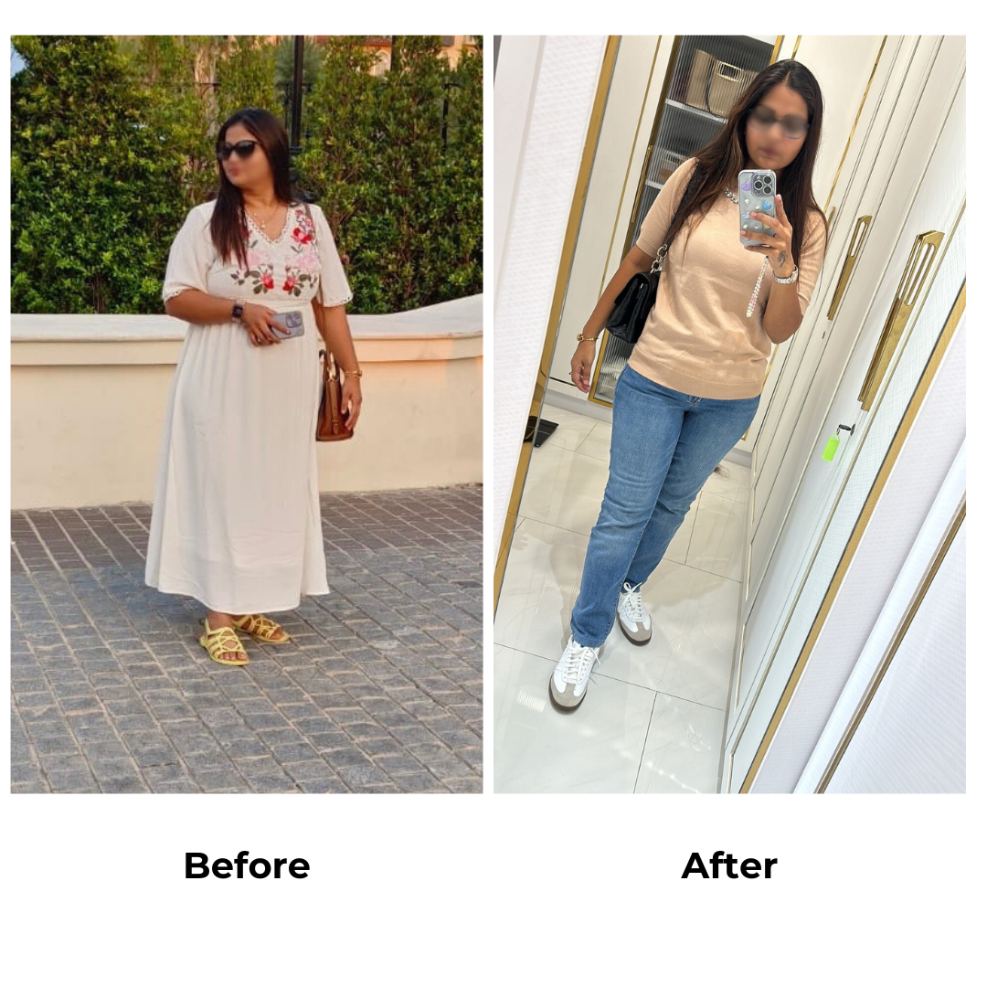 Mousami had gastric sleeve in Thailand