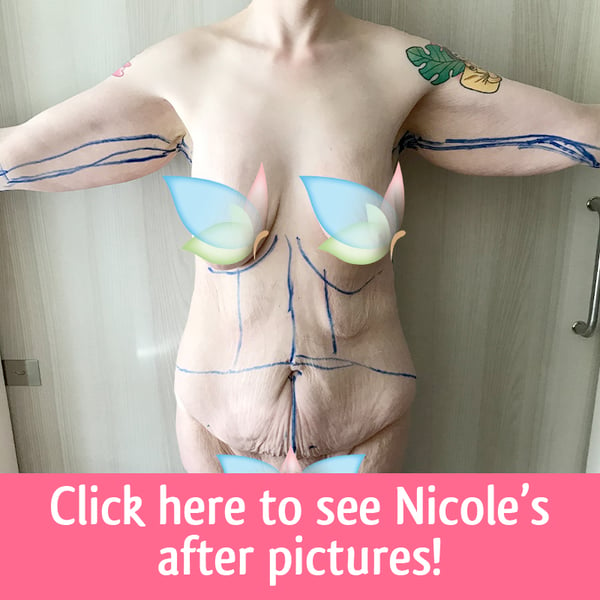 Nicole skin removal 