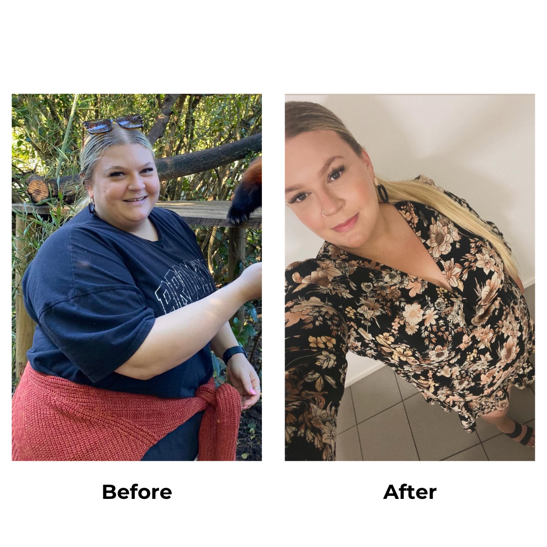 Riley had gastric sleeve surgery