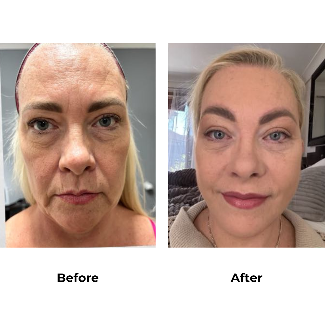 Rochelle had a facrlift with Dr. NJ