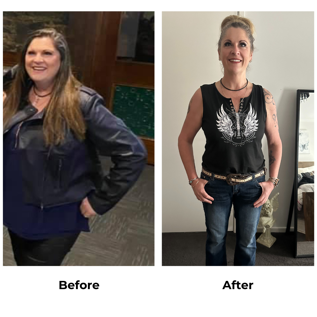 Sam had gastric sleeve surgery