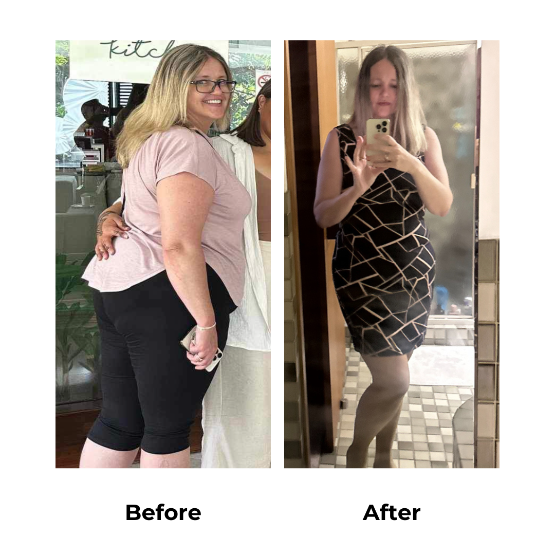 Samantha had gastric sleeve in Thailand