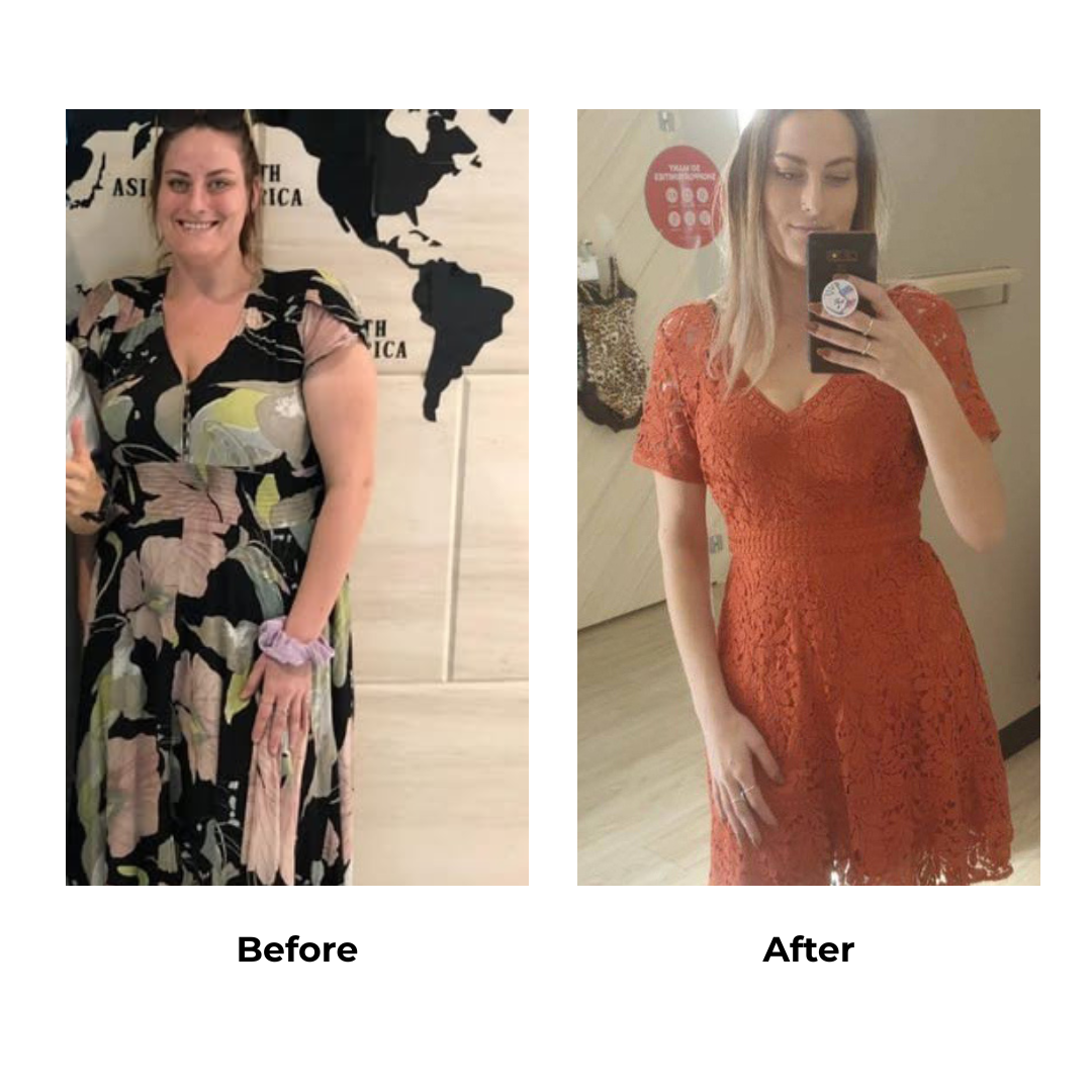 Sherilyn had gastric sleeve in Thailand (2)