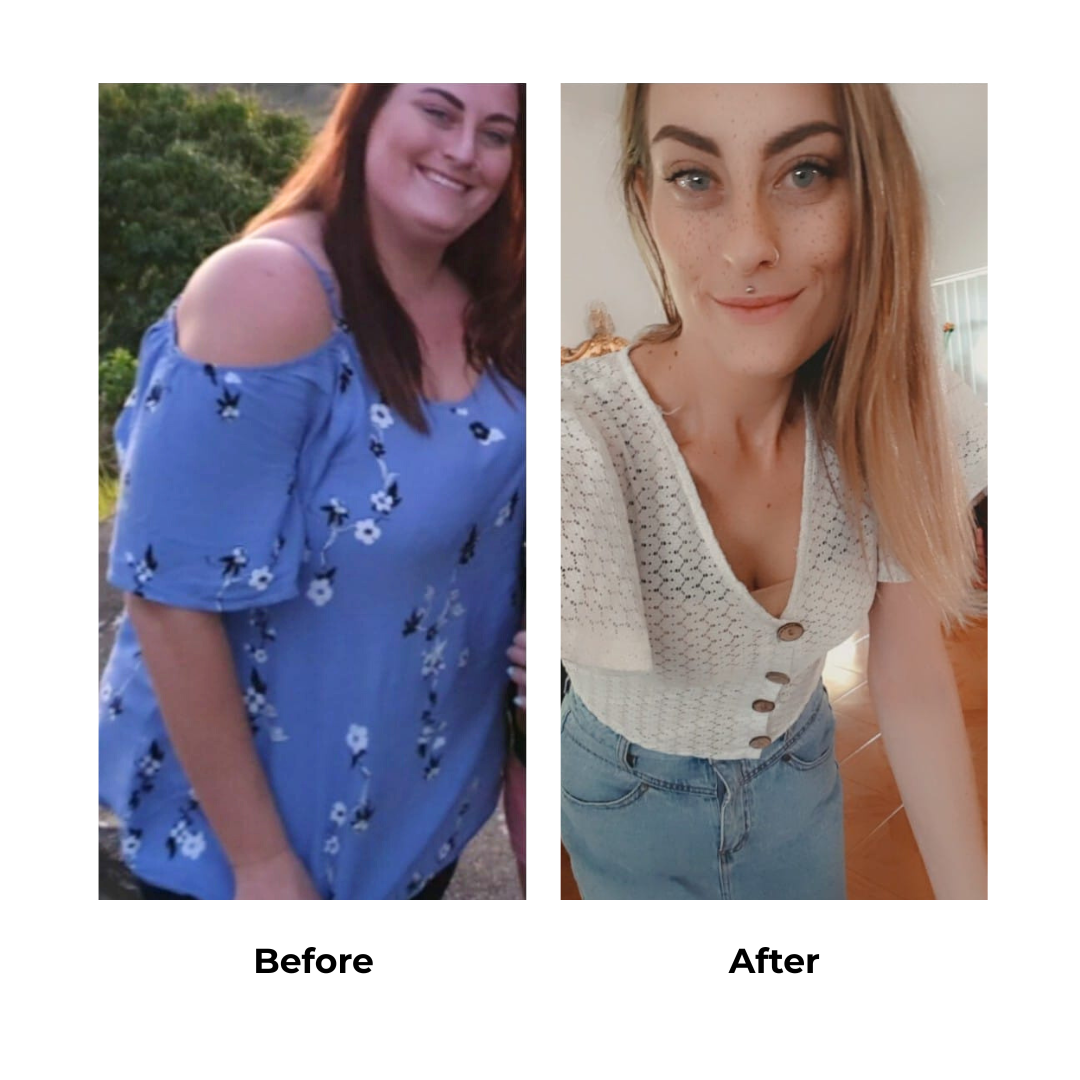 Sherilyn had gastric sleeve in Thailand