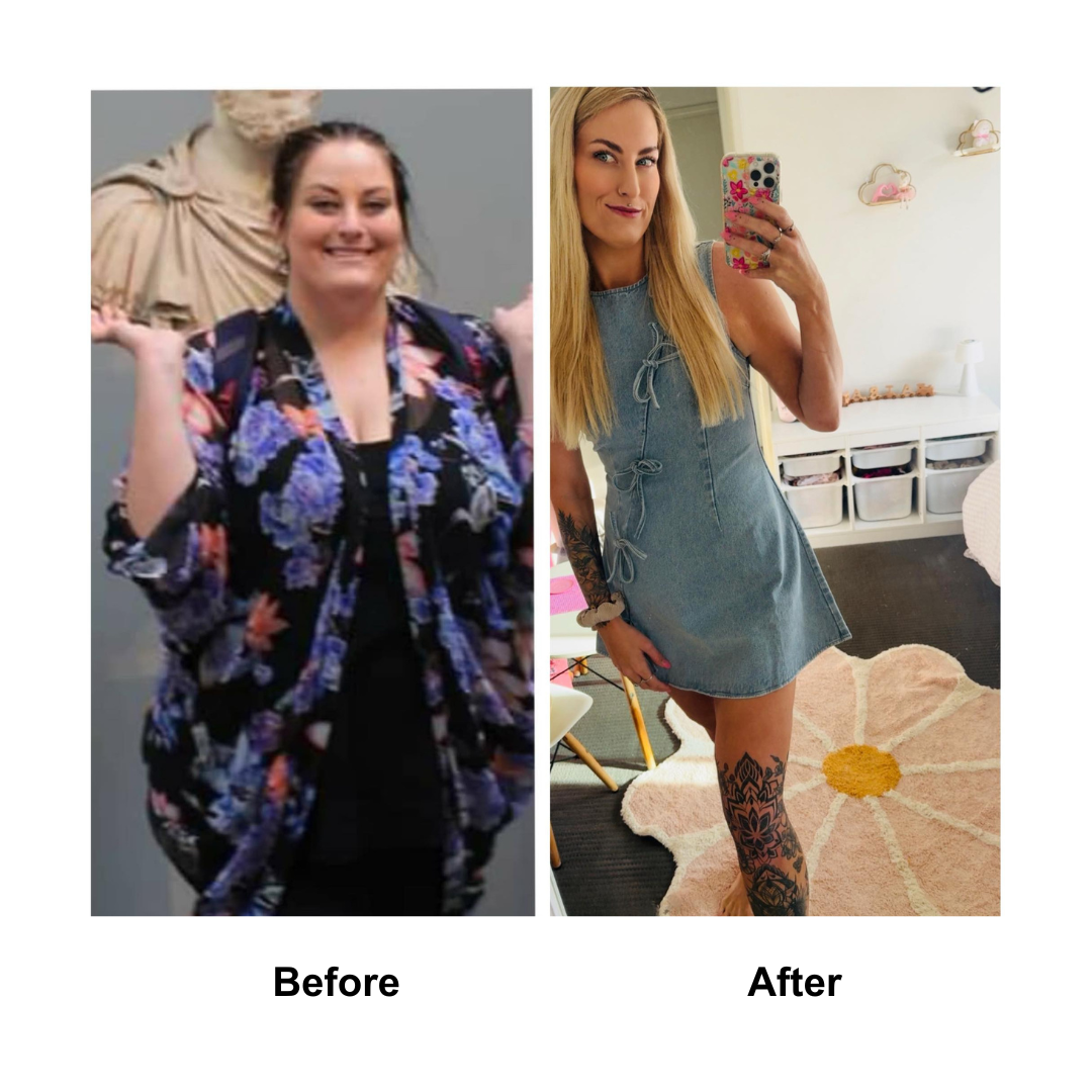 Sherilyn had weight loss surgery (1)