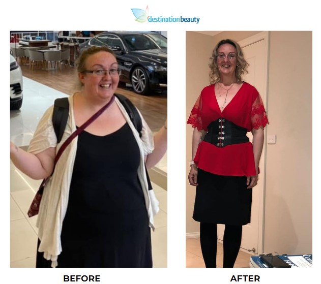 Tanna weight loss surgery 4