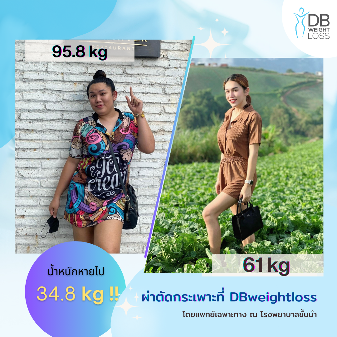 Thai patient weight loss surgery (4)