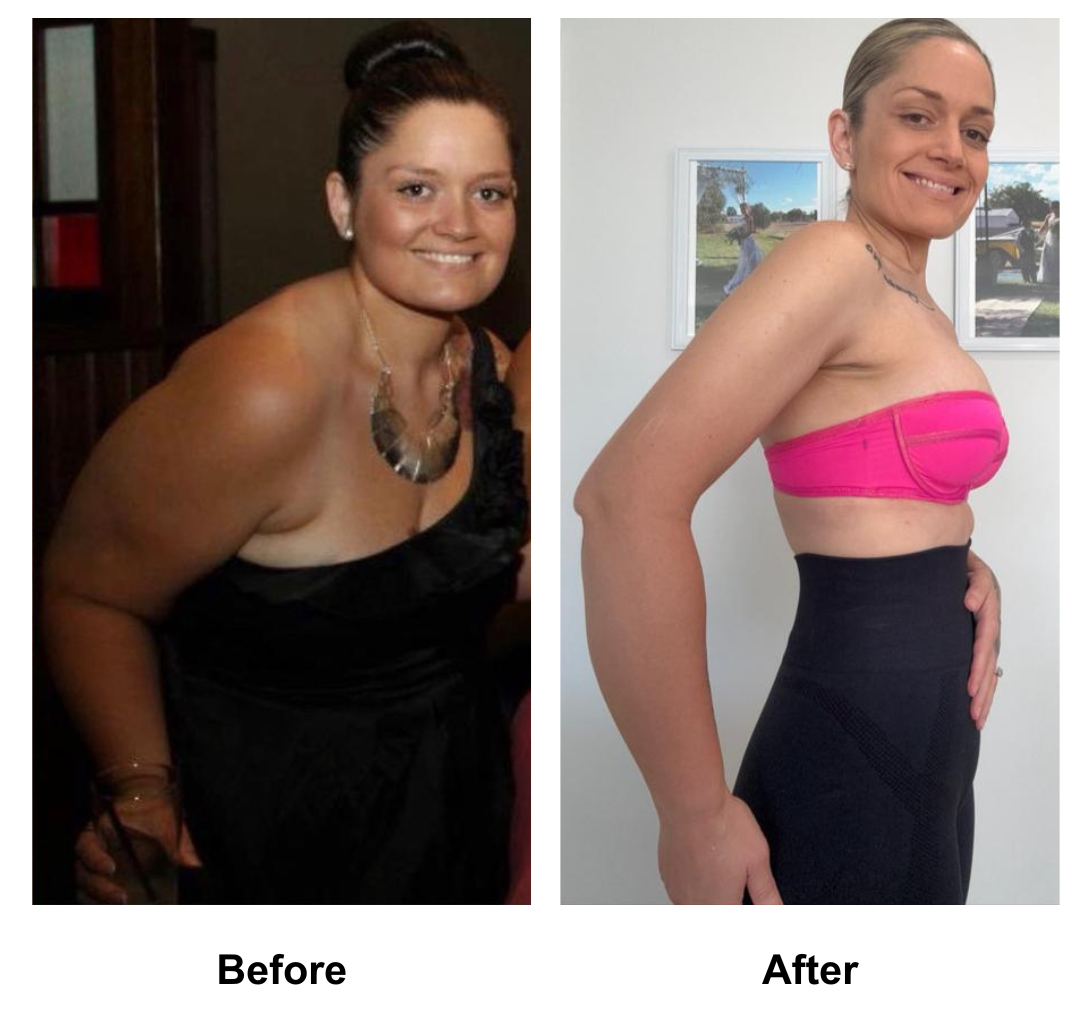 Vivien lost 80 kg